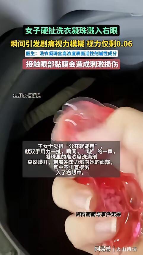 州一女子撕扯凝珠发生意外致眼睛失明瓦力棋